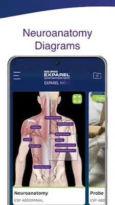 EXPAREL® NOW android App screenshot 8